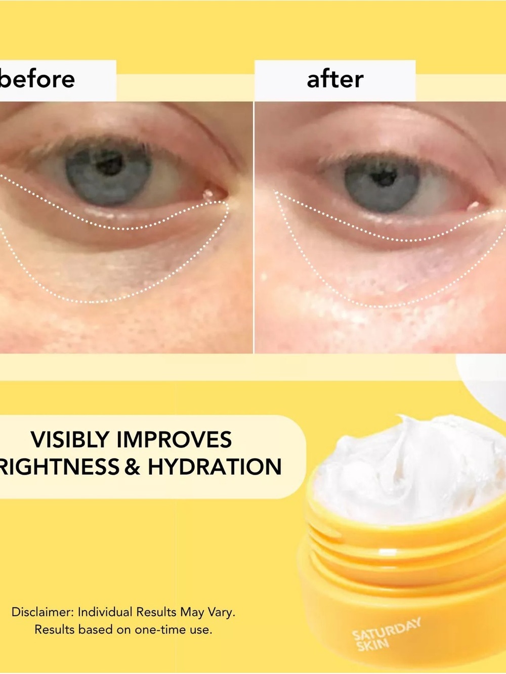 SATURDAY SKIN - Yuzu Vitamin C Bright Eye Cream - Picture 4 of 5